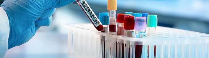 A gloved hand placing a labeled blood sample tube into a lab rack